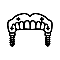 All-on-4 Implant Systems