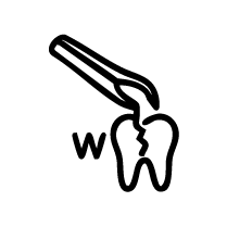 Broken Tooth Removal