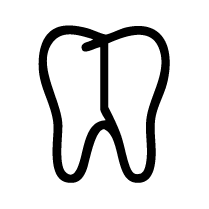 Front Tooth Root Canals