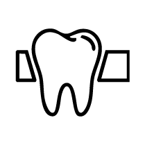 Front Tooth Replacement Bridges