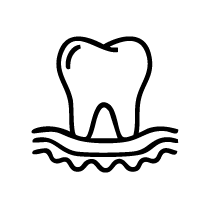 Gum Contouring and Reshaping