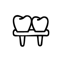 Implant Supported Bridges