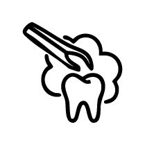 Infected Tooth Extractions