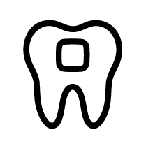 Medium Cavity Composite Fillings