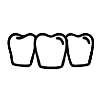 Posterior Tooth Replacement Bridges