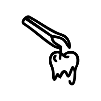 Severely Decayed Tooth Removal