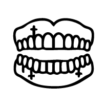 Sinus Lift for Implant Placement