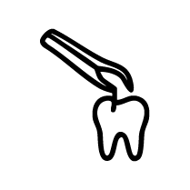 Surgical Extractions