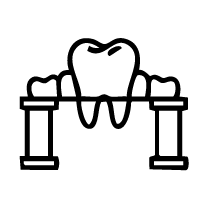 Traditional Dental Bridges